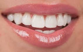Snowhite Teeth Whitening - tanden bleken - crème - waar te koop - gel